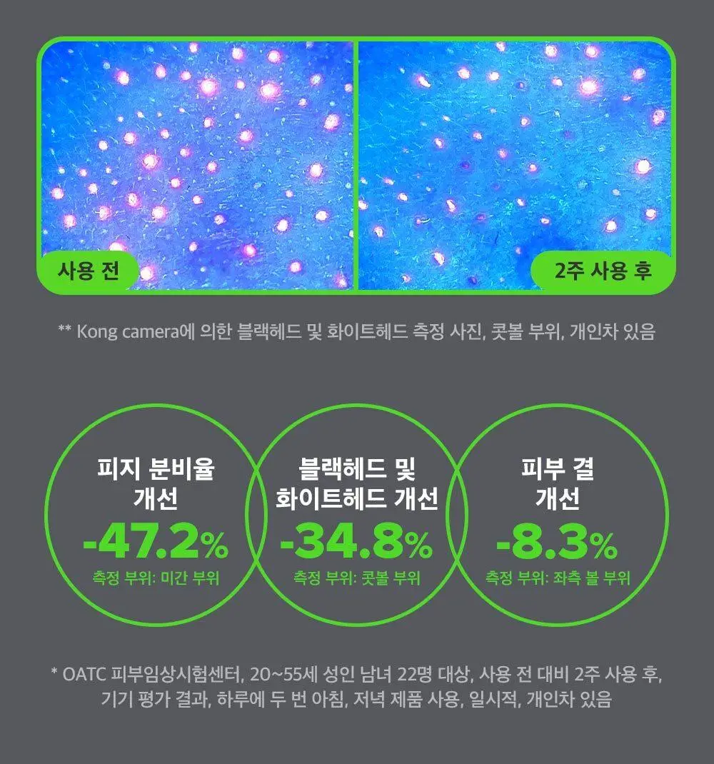 [모공컨트롤샷]폴라초이스 10% 나이아신아마이드 부스터 앰플 20ml 상세페이지 12